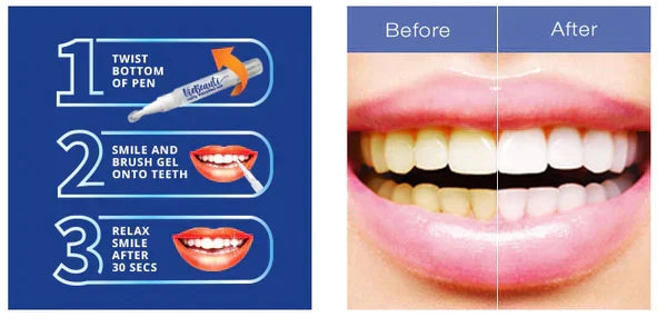 Teeth Whitening Pen